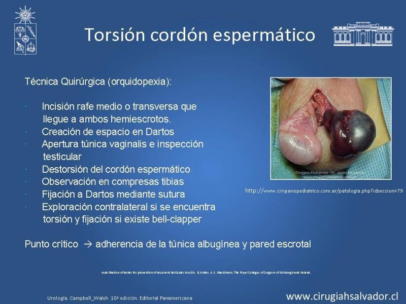 Diapositiva 13 de Escroto Agudo