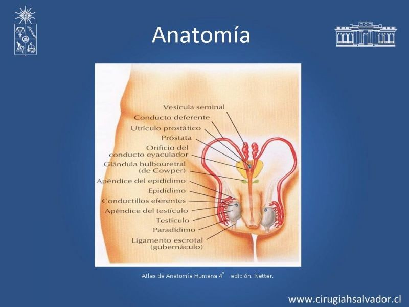 Diapositiva 2 de Escroto Agudo