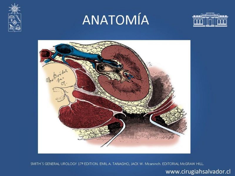 Diapositiva 3 de Nefrectomía técnica quirúrgica