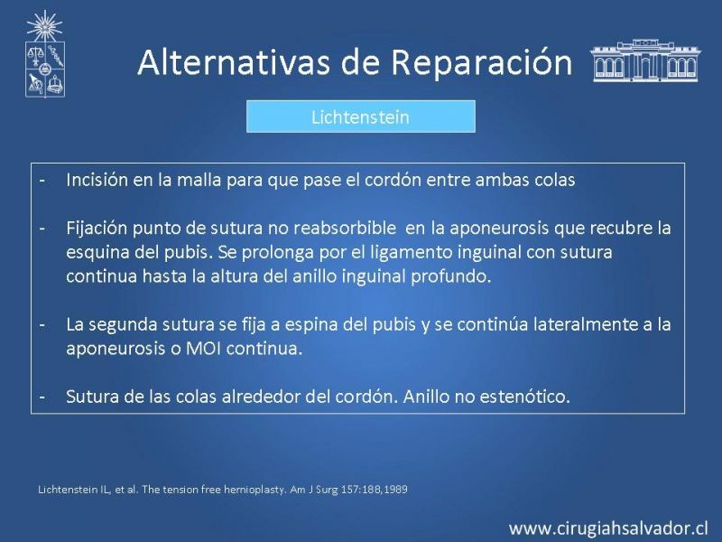 Diapositiva 18 de Alternativas actuales en el tratamiento de la Hernia Inguinal