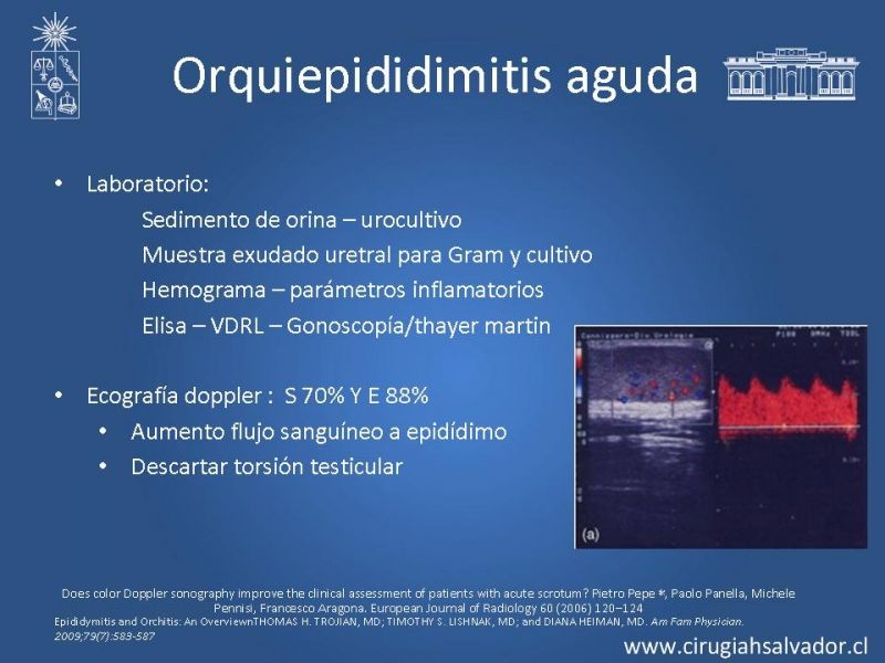 Diapositiva 23 de Escroto Agudo