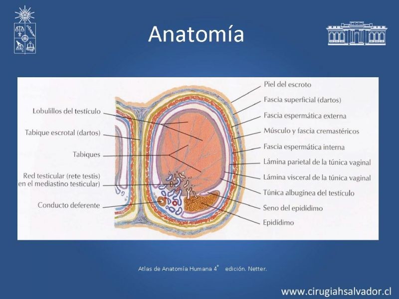 Diapositiva 3 de Escroto Agudo