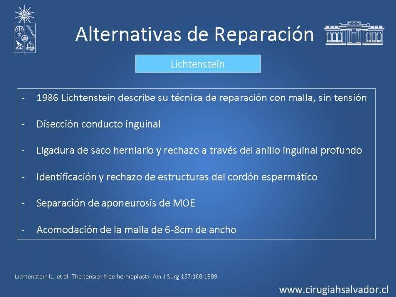 Diapositiva 17 de Alternativas actuales en el tratamiento de la Hernia Inguinal
