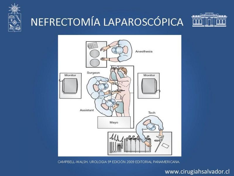 Diapositiva 19 de Nefrectomía técnica quirúrgica