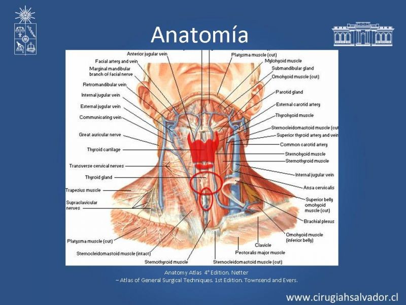 Diapositiva 1 de Traqueostomía