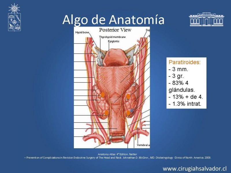 Diapositiva 1 de Hiperparatiroidismo Primario