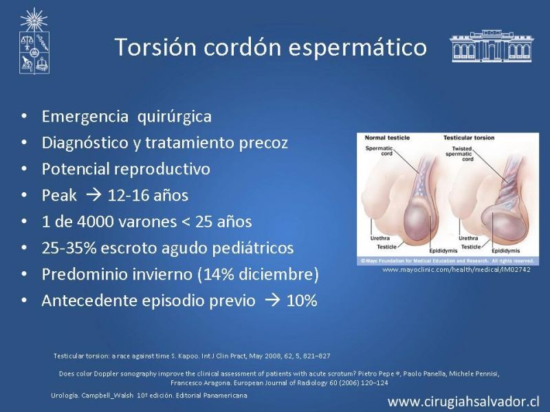 Diapositiva 5 de Escroto Agudo