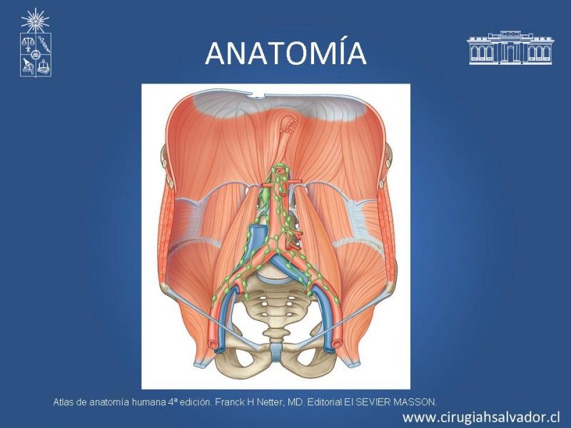 Diapositiva 6 de Nefrectomía técnica quirúrgica