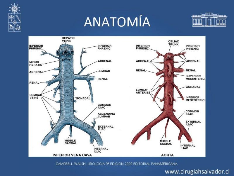 Diapositiva 2 de Nefrectomía técnica quirúrgica