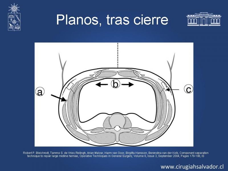 Diapositiva 22 de Separación de componentes