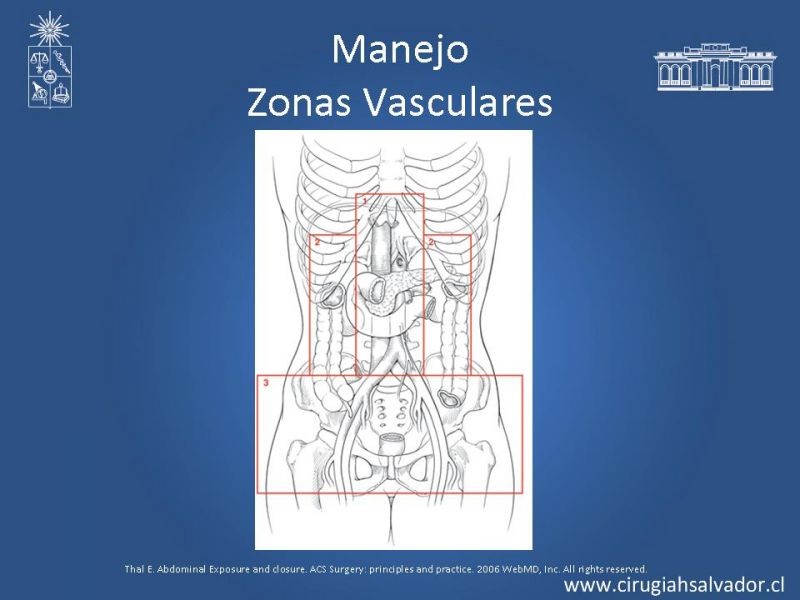 Diapositiva 21 de Lesiones Vasculares Abdominales