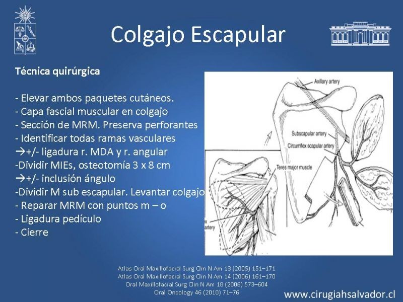 Diapositiva 26 de Alternativas de Reconstrucción Mandibular