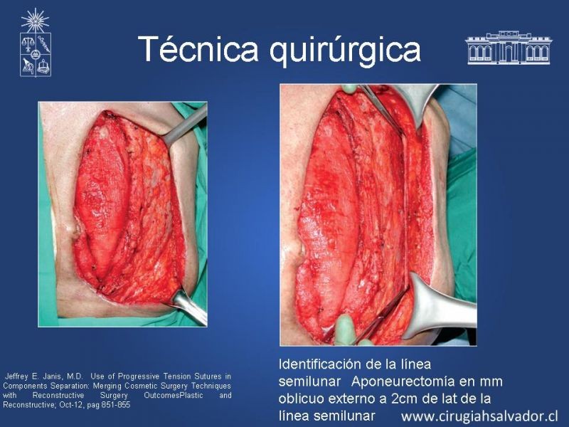Diapositiva 15 de Separación de componentes