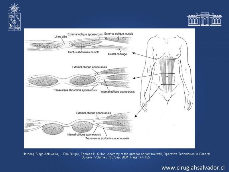 Diapositiva 7 de Separación de componentes
