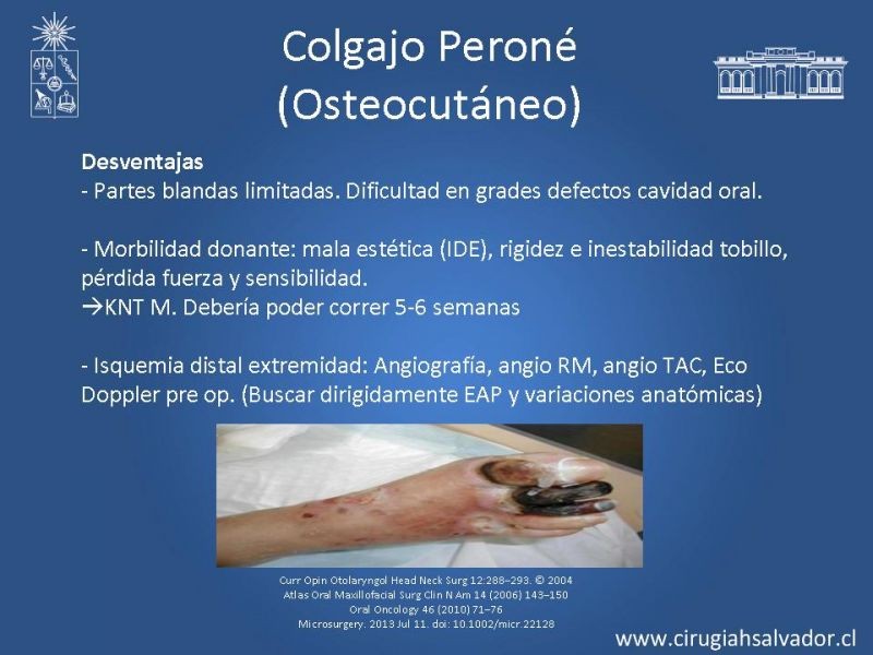 Diapositiva 16 de Alternativas de Reconstrucción Mandibular