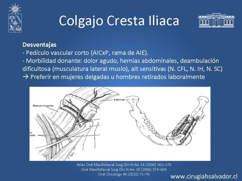 Diapositiva 22 de Alternativas de Reconstrucción Mandibular