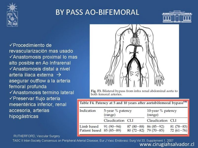 Diapositiva 19 de Manejo de Isquemia Critica de Extremidades Inferiores