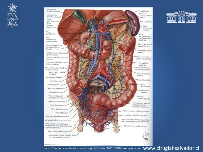 Diapositiva 11 de Lesiones Vasculares Abdominales