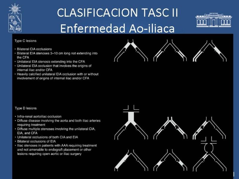Diapositiva 10 de Manejo de Isquemia Critica de Extremidades Inferiores