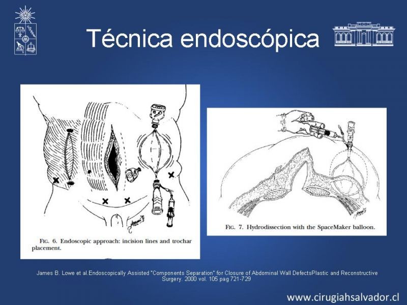 Diapositiva 31 de Separación de componentes