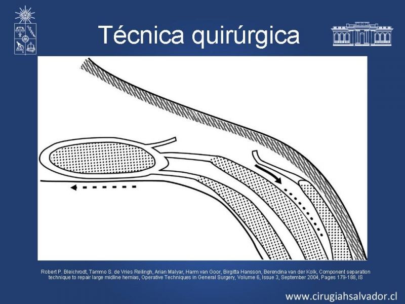 Diapositiva 14 de Separación de componentes