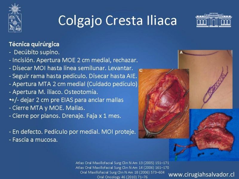 Diapositiva 23 de Alternativas de Reconstrucción Mandibular