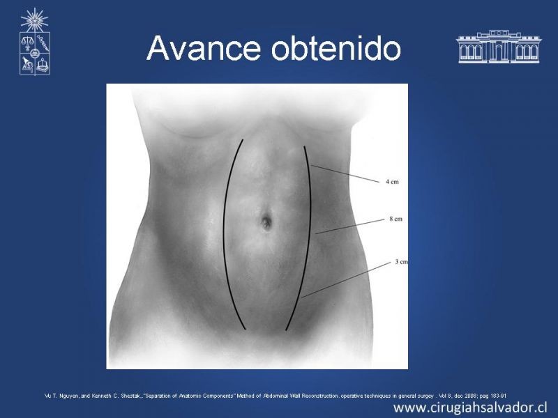 Diapositiva 17 de Separación de componentes