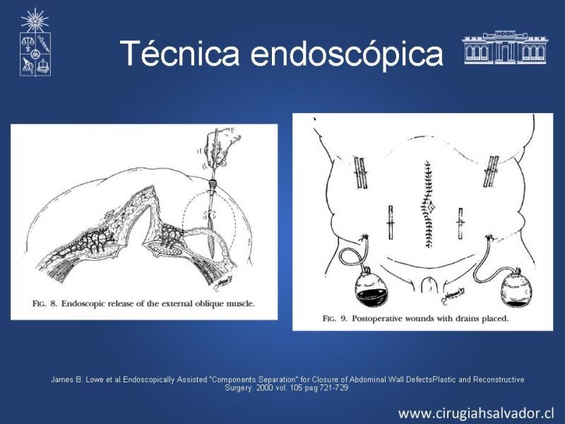 Diapositiva 32 de Separación de componentes