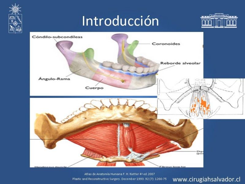 Diapositiva 5 de Alternativas de Reconstrucción Mandibular