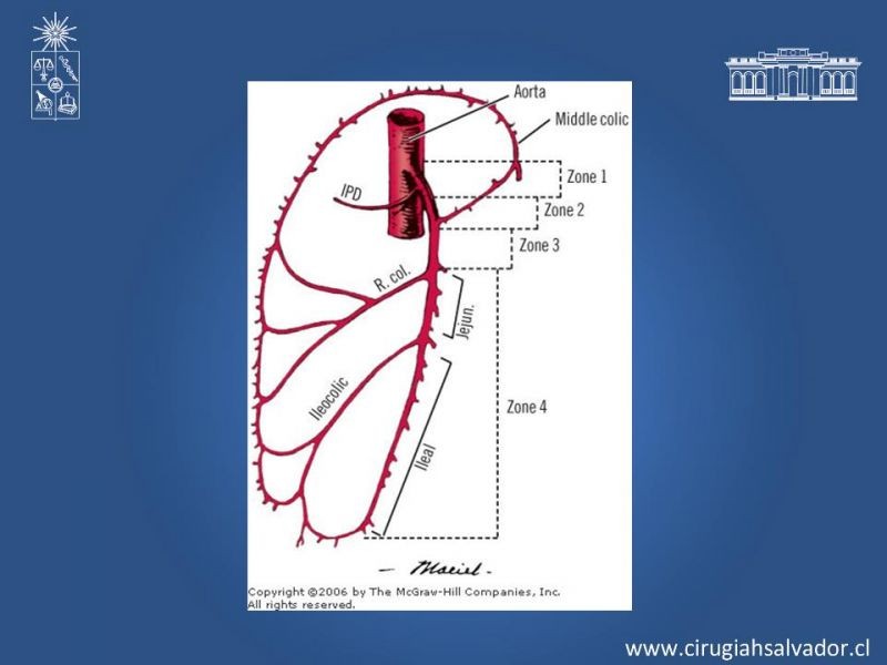 Diapositiva 8 de Lesiones Vasculares Abdominales