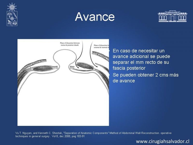 Diapositiva 18 de Separación de componentes