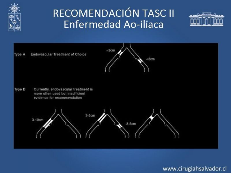 Diapositiva 11 de Manejo de Isquemia Critica de Extremidades Inferiores