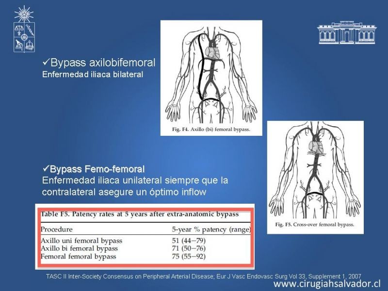 Diapositiva 23 de Manejo de Isquemia Critica de Extremidades Inferiores