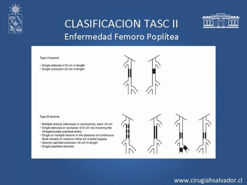 Diapositiva 13 de Manejo de Isquemia Critica de Extremidades Inferiores