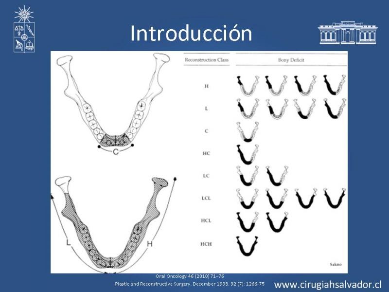 Diapositiva 7 de Alternativas de Reconstrucción Mandibular