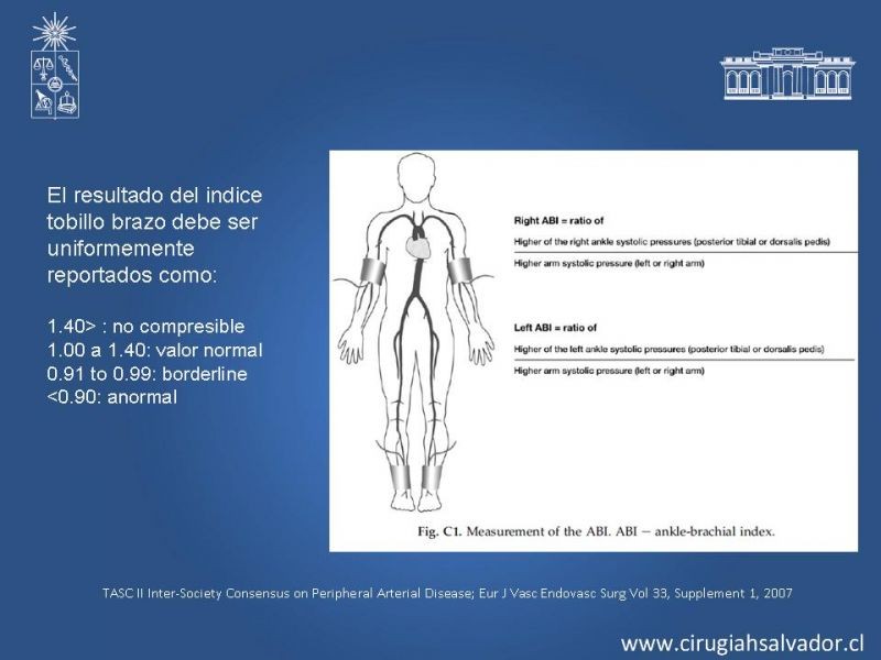 Diapositiva 3 de Manejo de Isquemia Critica de Extremidades Inferiores