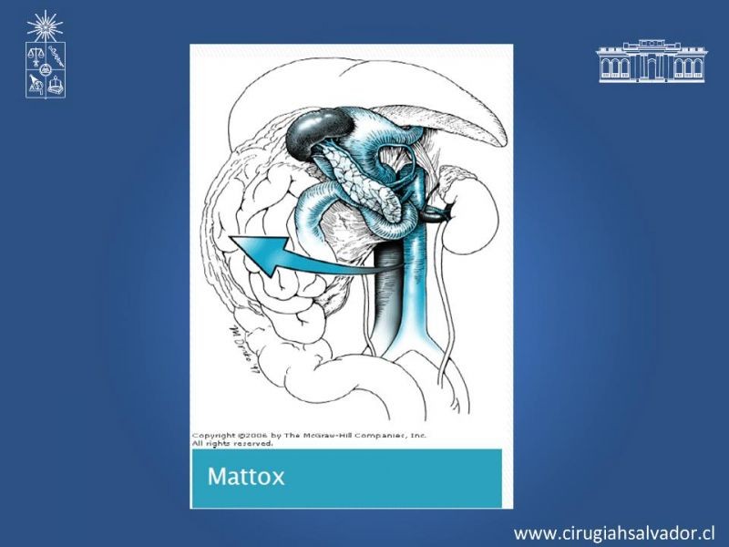 Diapositiva 24 de Lesiones Vasculares Abdominales