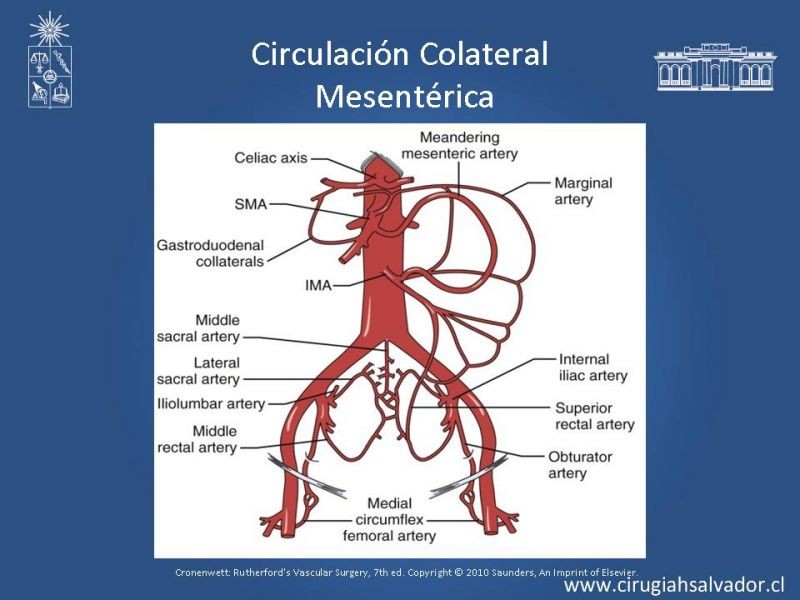 Diapositiva 13 de Lesiones Vasculares Abdominales