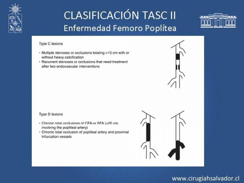 Diapositiva 14 de Manejo de Isquemia Critica de Extremidades Inferiores