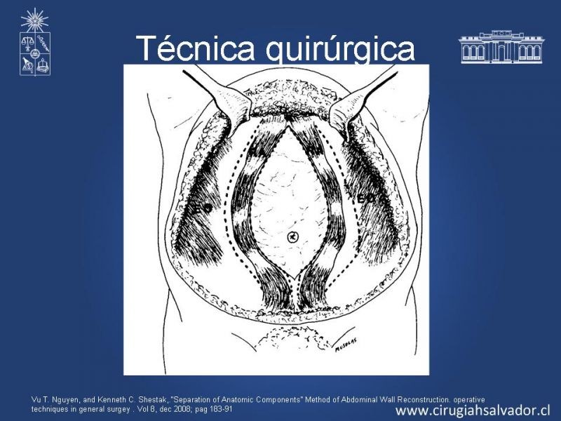 Diapositiva 11 de Separación de componentes