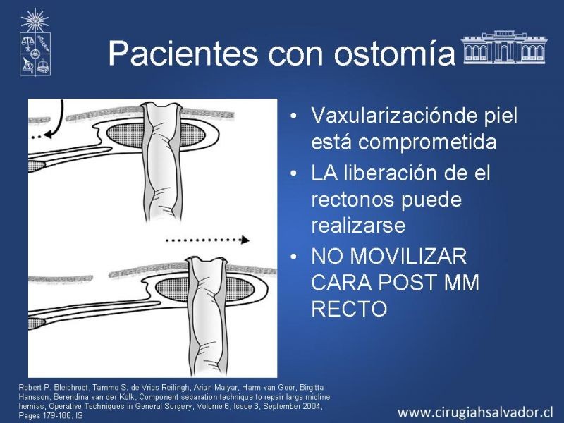 Diapositiva 25 de Separación de componentes