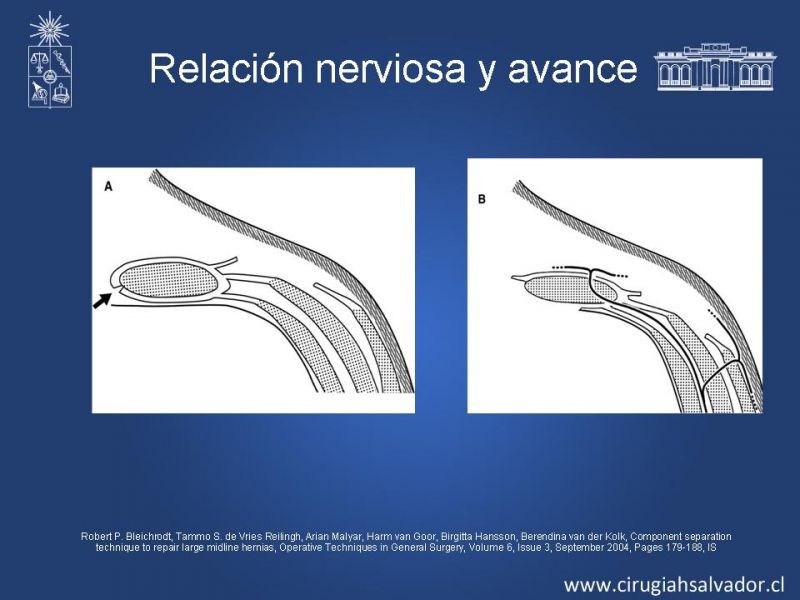 Diapositiva 20 de Separación de componentes