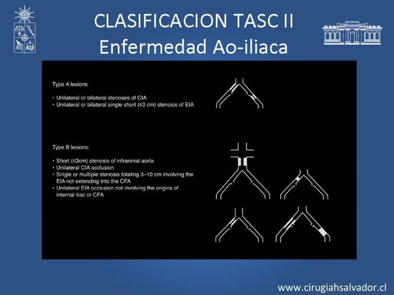 Diapositiva 9 de Manejo de Isquemia Critica de Extremidades Inferiores