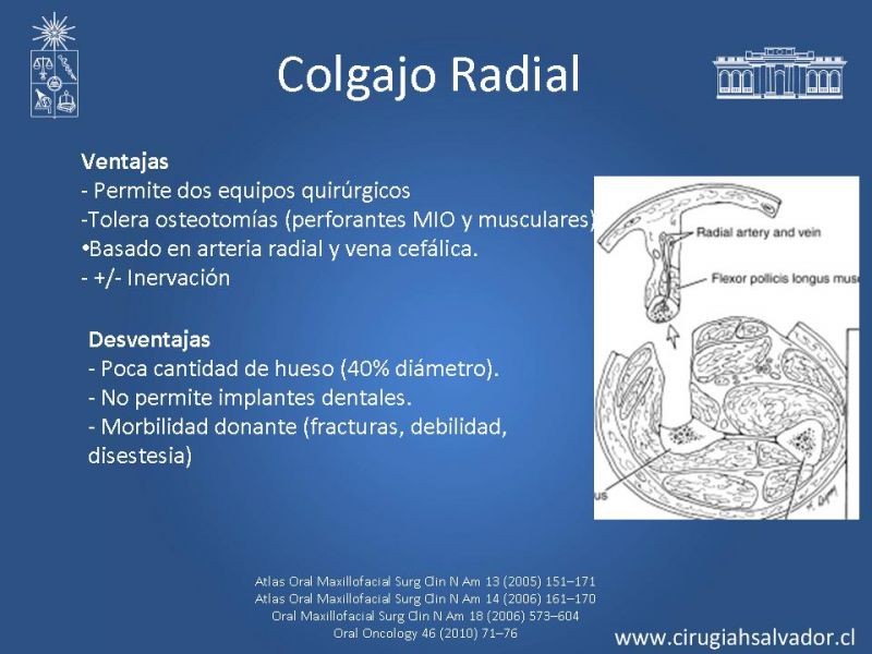 Diapositiva 27 de Alternativas de Reconstrucción Mandibular