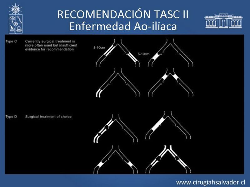 Diapositiva 12 de Manejo de Isquemia Critica de Extremidades Inferiores
