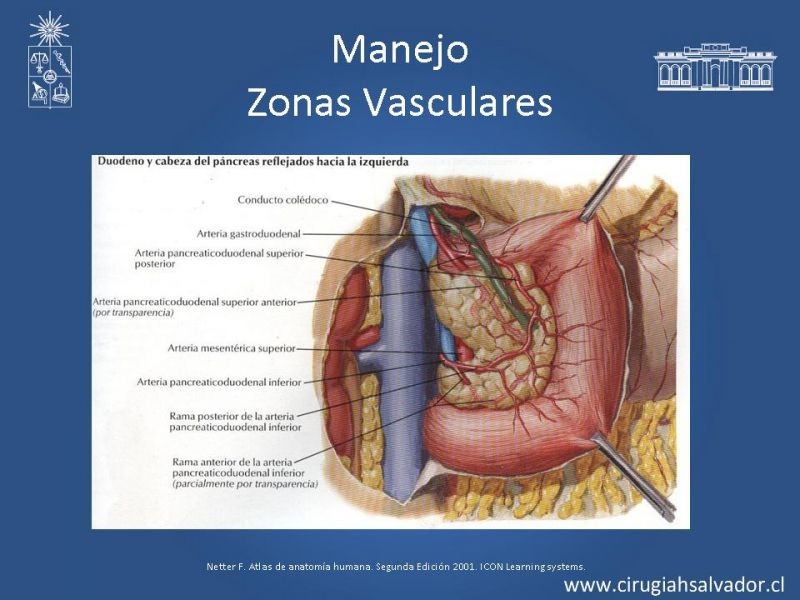 Diapositiva 30 de Lesiones Vasculares Abdominales