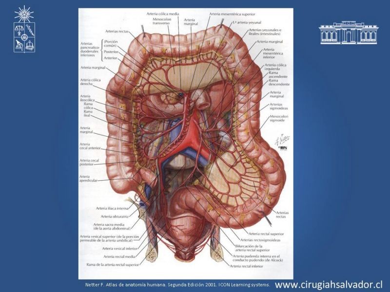 Diapositiva 10 de Lesiones Vasculares Abdominales