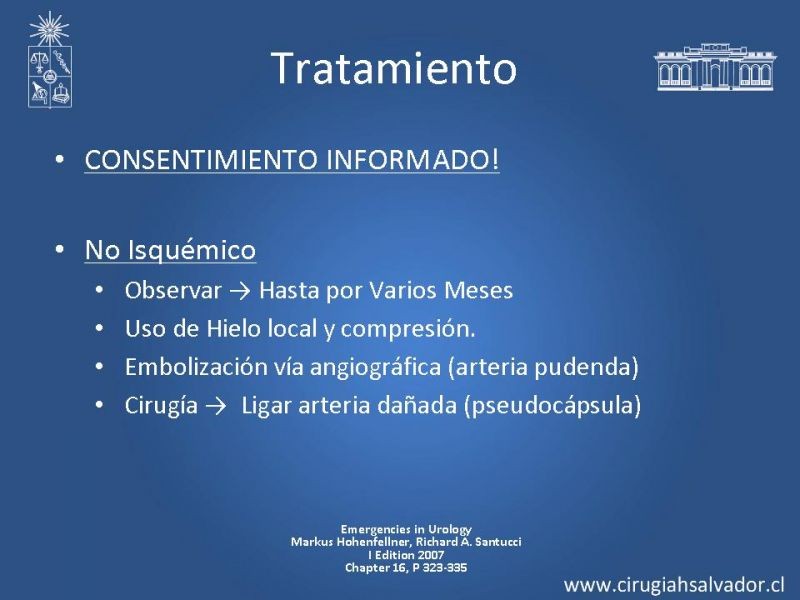 Diapositiva 13 de Priapismo
