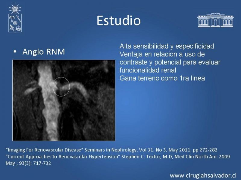 Diapositiva 13 de Hipertensión Renovascular