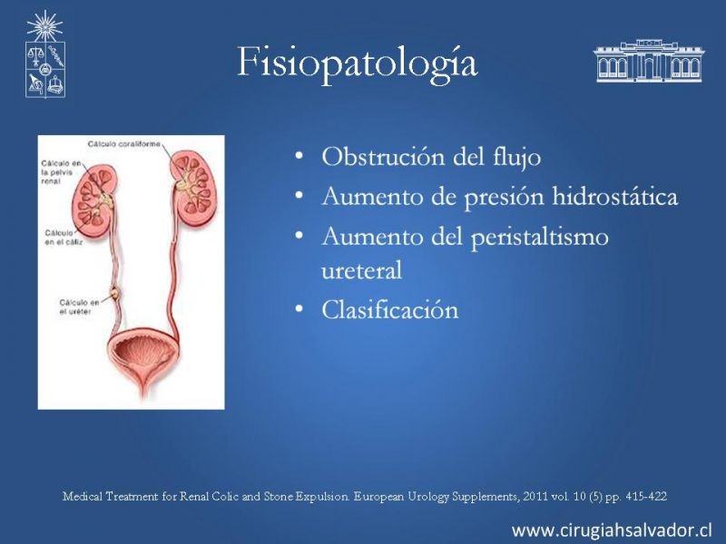 Diapositiva 3 de Urolitiasis: Manejo en urgencia